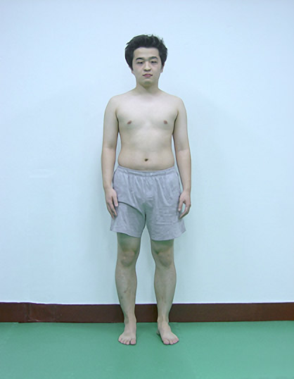 바로 선 자세 후면 평가