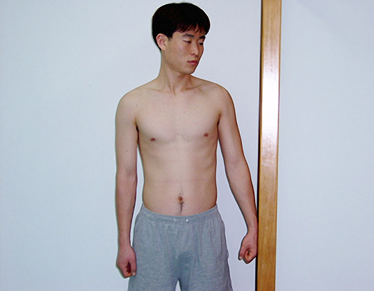 견관절 외전의 등척성 운동