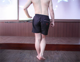 트렌델렌버그 징후